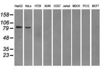 Anti-PDE10A antibody [1B2] used in Western Blot (WB). GTX83931