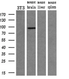 Anti-PDE10A antibody [1C9] used in Western Blot (WB). GTX83933