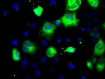 Anti-PCSK7 antibody [1B8] used in Immunocytochemistry/ Immunofluorescence (ICC/IF). GTX83934