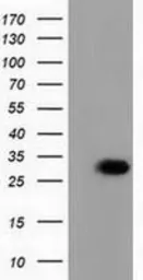 Anti-PBLD antibody [7G5] used in Western Blot (WB). GTX83938