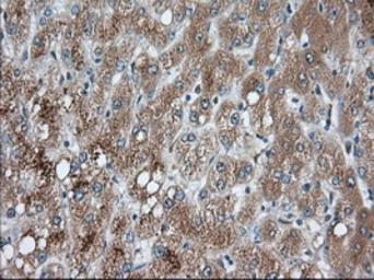 Anti-PANK2 antibody [3H9] used in IHC (Paraffin sections) (IHC-P). GTX83944