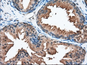 Anti-PANK2 antibody [3H9] used in IHC (Paraffin sections) (IHC-P). GTX83944