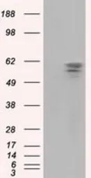 Anti-PANK2 antibody [3H9] used in Western Blot (WB). GTX83944