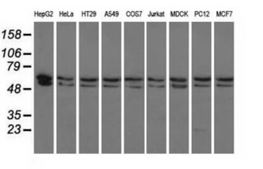 Anti-PANK2 antibody [3H9] used in Western Blot (WB). GTX83944