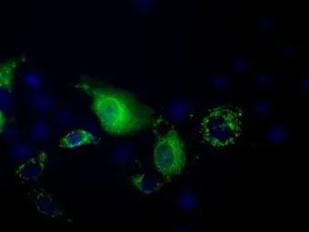 Anti-PANK2 antibody [3H9] used in Immunocytochemistry/ Immunofluorescence (ICC/IF). GTX83944
