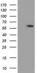 Anti-PANK2 antibody [3G4] used in Western Blot (WB). GTX83946