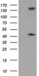 Anti-PAICS antibody [5B6] used in Western Blot (WB). GTX83949