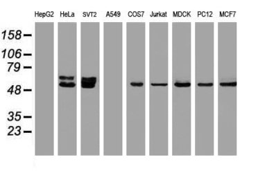 Anti-OXSR1 antibody [1F3] used in Western Blot (WB). GTX83951