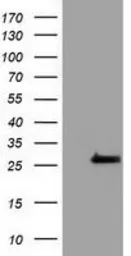Anti-OTUB2 antibody [6C7] used in Western Blot (WB). GTX83952