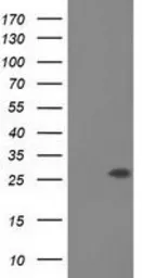 Anti-OTUB2 antibody [11B3] used in Western Blot (WB). GTX83953