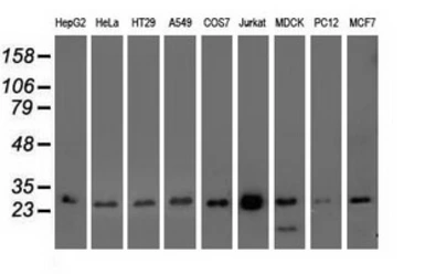 Anti-OTUB2 antibody [11B3] used in Western Blot (WB). GTX83953