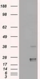 Anti-Oncostatin M antibody [2B6] used in Western Blot (WB). GTX83959