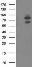 Anti-OSBPL11 antibody [6H9] used in Western Blot (WB). GTX83963