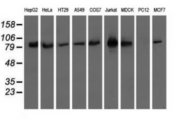 Anti-OSBPL11 antibody [6H9] used in Western Blot (WB). GTX83963