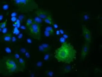 Anti-OSBPL11 antibody [6H9] used in Immunocytochemistry/ Immunofluorescence (ICC/IF). GTX83963