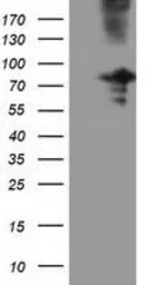 Anti-OSBPL11 antibody [7B3] used in Western Blot (WB). GTX83965