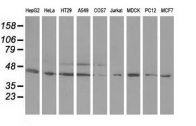 Anti-ODC antibody [1G6] used in Western Blot (WB). GTX83968