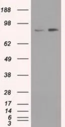 Anti-TrkC antibody [19B8] used in Western Blot (WB). GTX83976