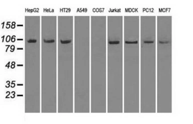 Anti-TrkC antibody [19B8] used in Western Blot (WB). GTX83976