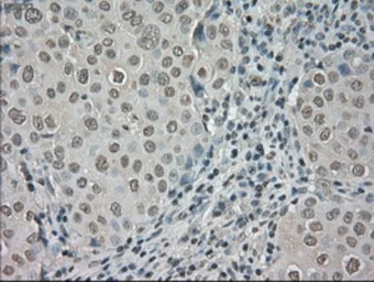 Anti-TrkC antibody [2B8] used in IHC (Paraffin sections) (IHC-P). GTX83978