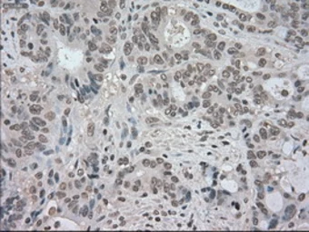 Anti-TrkC antibody [2B8] used in IHC (Paraffin sections) (IHC-P). GTX83978