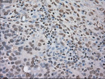 Anti-TrkC antibody [2B8] used in IHC (Paraffin sections) (IHC-P). GTX83978