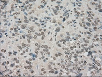 Anti-TrkC antibody [2B8] used in IHC (Paraffin sections) (IHC-P). GTX83978