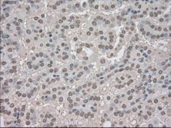 Anti-TrkC antibody [2B8] used in IHC (Paraffin sections) (IHC-P). GTX83978
