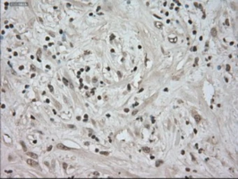 Anti-TrkC antibody [2B8] used in IHC (Paraffin sections) (IHC-P). GTX83978