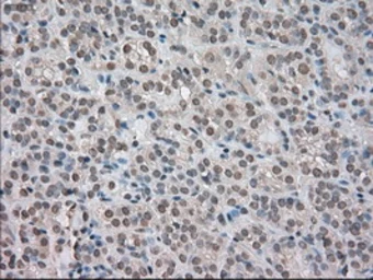 Anti-TrkC antibody [2B8] used in IHC (Paraffin sections) (IHC-P). GTX83978