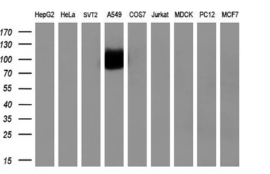 Anti-TrkC antibody [2B8] used in Western Blot (WB). GTX83978
