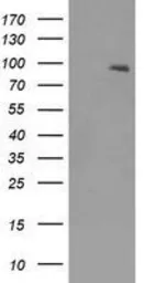 Anti-TrkB antibody [2E1] used in Western Blot (WB). GTX83980