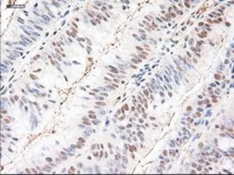 Anti-Neurotrophin 3 antibody [5C7] used in IHC (Paraffin sections) (IHC-P). GTX83983