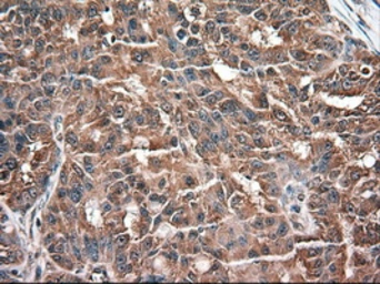 Anti-Neurotrophin 3 antibody [5C7] used in IHC (Paraffin sections) (IHC-P). GTX83983