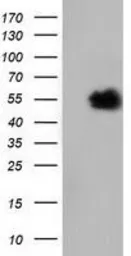 Anti-NT5DC1 antibody [1E11] used in Western Blot (WB). GTX83992