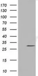 Anti-NSE2 antibody [6A6] used in Western Blot (WB). GTX83995