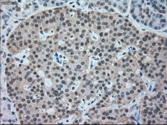 Anti-NRBP1 antibody [7E2] used in IHC (Paraffin sections) (IHC-P). GTX84000