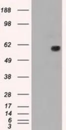 Anti-NRBP1 antibody [7E2] used in Western Blot (WB). GTX84000