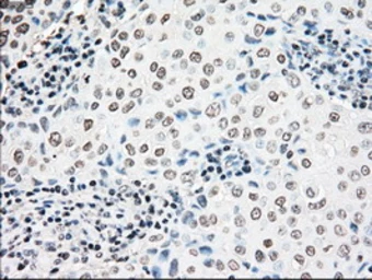 Anti-NRBP1 antibody [5C3] used in IHC (Paraffin sections) (IHC-P). GTX84007