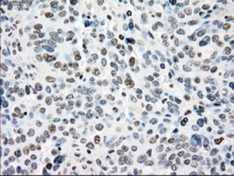 Anti-NRBP1 antibody [5C3] used in IHC (Paraffin sections) (IHC-P). GTX84007