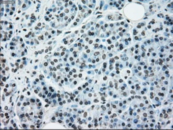 Anti-NRBP1 antibody [5C3] used in IHC (Paraffin sections) (IHC-P). GTX84007