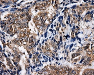Anti-NPR-C antibody [2G2] used in IHC (Paraffin sections) (IHC-P). GTX84008