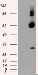 Anti-NPR-C antibody [2G2] used in Western Blot (WB). GTX84008