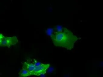Anti-NPR-C antibody [2G2] used in Immunocytochemistry/ Immunofluorescence (ICC/IF). GTX84008
