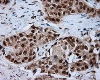 Anti-NPR-C antibody [4C3] used in IHC (Paraffin sections) (IHC-P). GTX84010