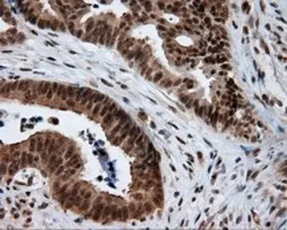 Anti-NPR-C antibody [4C3] used in IHC (Paraffin sections) (IHC-P). GTX84010