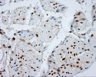 Anti-NPR-C antibody [4C3] used in IHC (Paraffin sections) (IHC-P). GTX84010