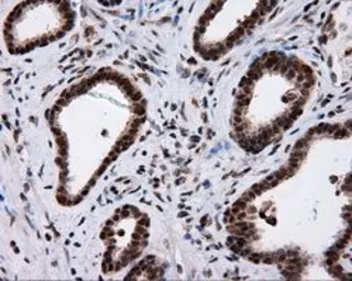 Anti-NPR-C antibody [4C3] used in IHC (Paraffin sections) (IHC-P). GTX84010