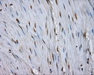 Anti-NPR-C antibody [4C3] used in IHC (Paraffin sections) (IHC-P). GTX84010