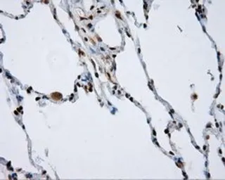 Anti-NPR-C antibody [4C3] used in IHC (Paraffin sections) (IHC-P). GTX84010